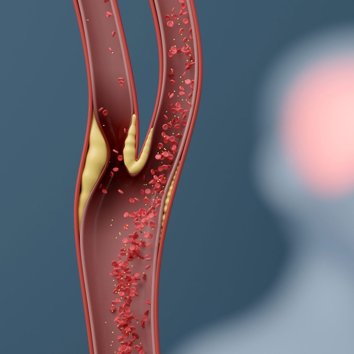 what are good and bad cholesterol