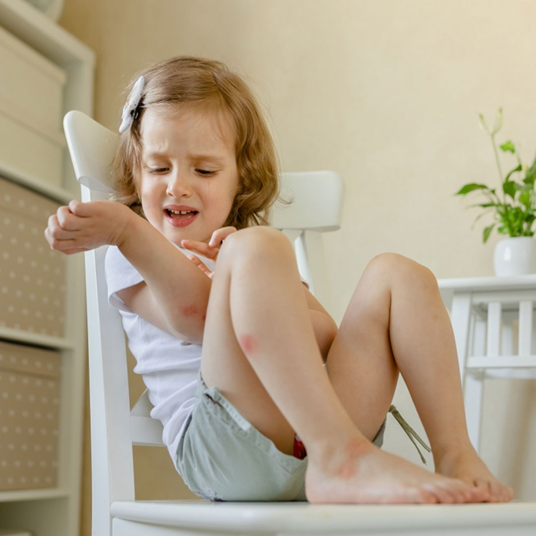 allergies in children